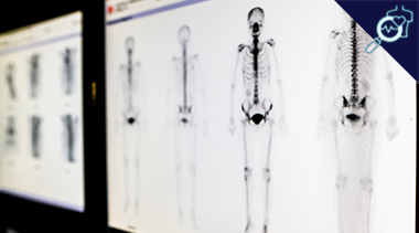 SPECT/CT (Single Photon Emission Computed Tomography/Computed Tomography